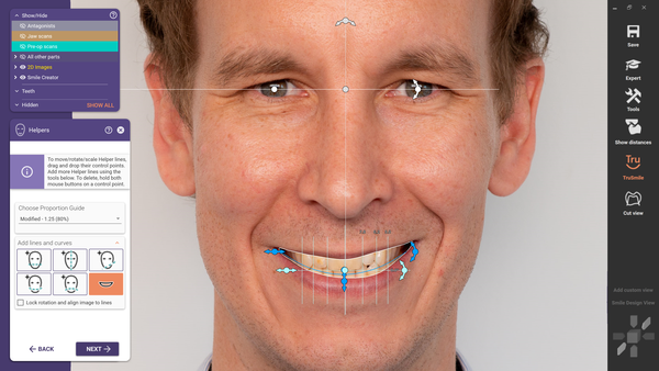 △ DentalCAD 3.0 Galway에는 기존 Smile Creator 기능에 AI 기술이 적용됐다. 입술 선이나 안구 위치와 같은 얼굴의 특징을 자동으로 감지해 스마일 디자인을 지원하기에 사용자가 보다 빨리 심미적 제안을 도출해 낼 수 있다. 덕분에 케이스 디자인 시 귀중한 시간을 절약하게 해준다.