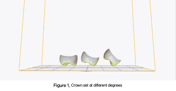 Figure 1. Crown set at different degrees